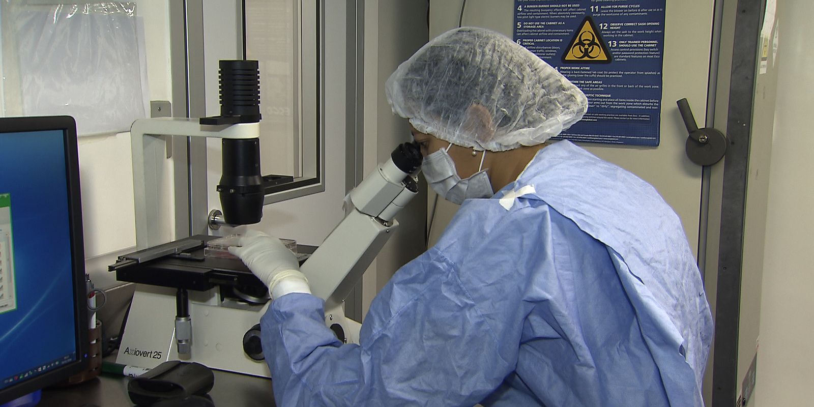 Cientistas anunciam novos casos de remissão de HIV após transplante de células-tronco