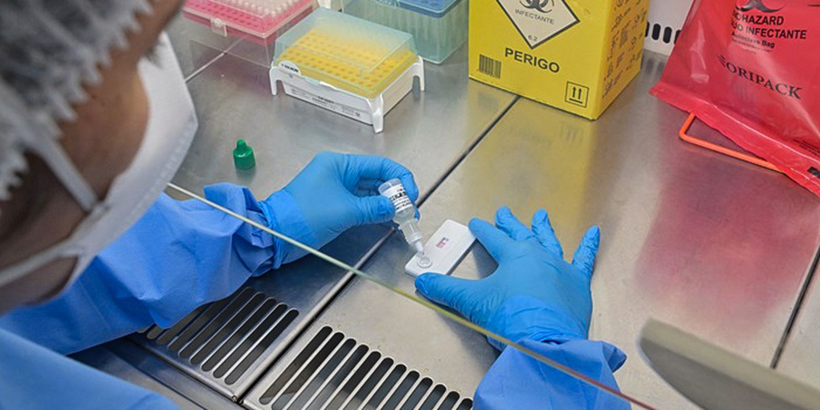 Anvisa atualiza regras para laboratórios de controle de qualidade