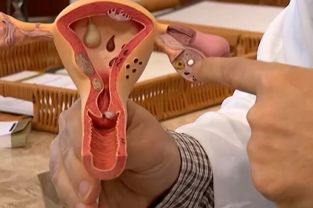 CNPq lança edital para financiar pesquisas sobre endometriose e saúde menstrual