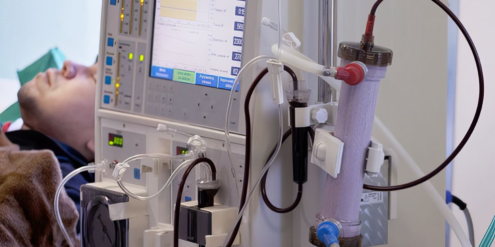 Estudo mostra subdiagnóstico: milhões podem ter doença renal no Brasil