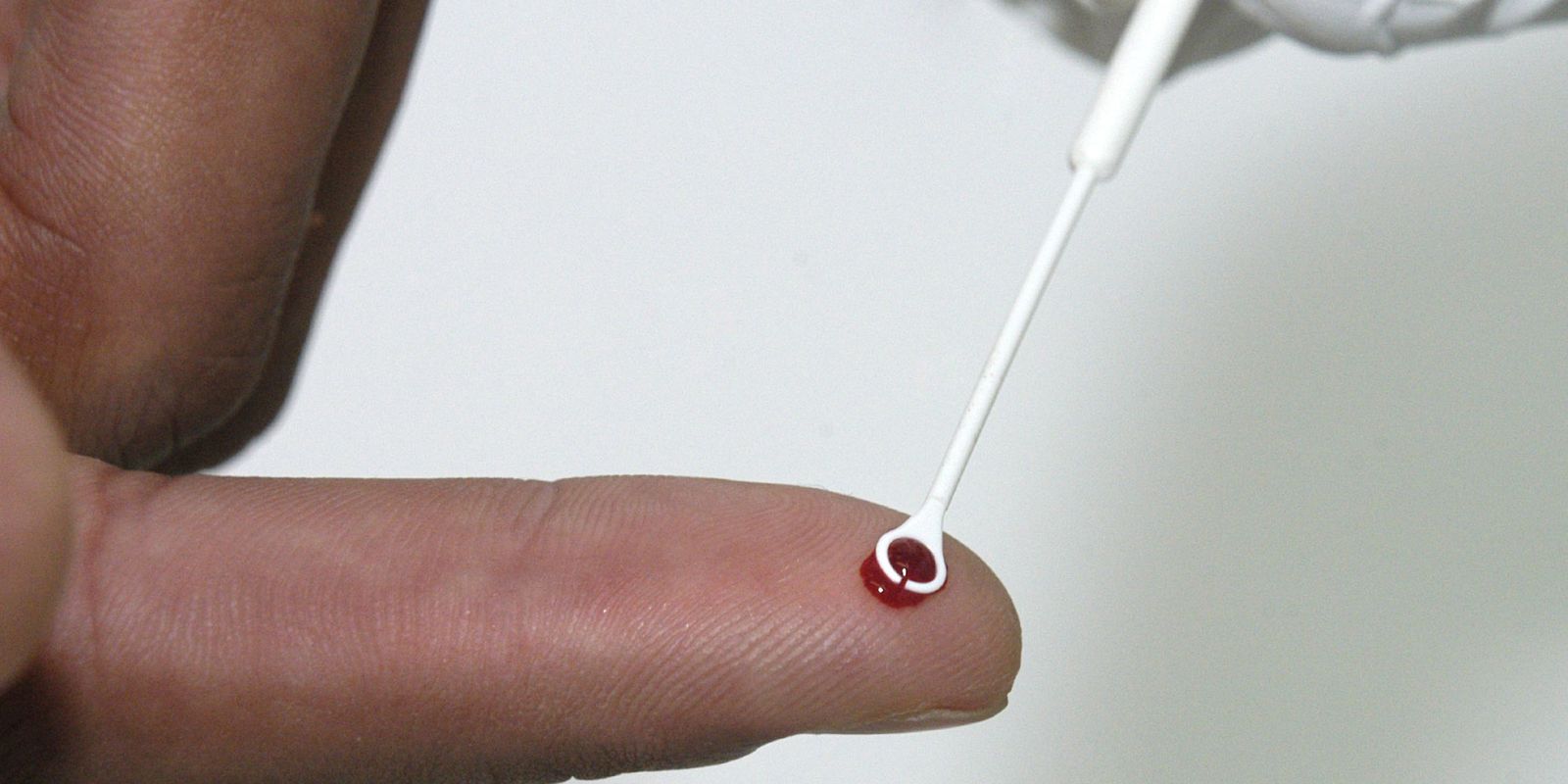 Fiji aciona emergência nacional após salto nos casos de HIV